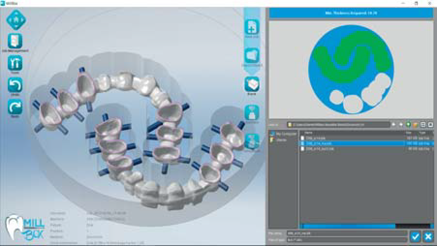 MillBox Dental CAM Software ETI Empire Direct